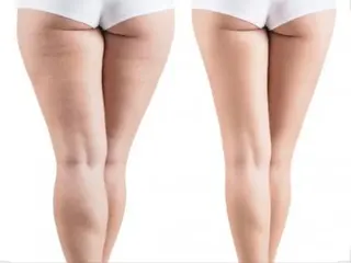 ショート カラー パーマ ヘアアレンジ メンズ キッズ ネイル マツエク・マツパ ‍痩身＆ボディ 結果出し🌟丹野のエステ・リラクイメージ