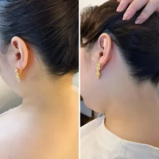 うなじ脱毛/美肌脱毛 LABELのエステ・リラクイメージ