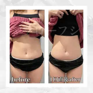 部分痩せ♥️小顔専門 MIKUのエステ・リラクイメージ