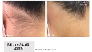 viage所属・viage 脱毛&フェイシャル店のエステ・リラクイメージ