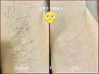 R•sugar アールシュガーのエステ・リラクイメージ