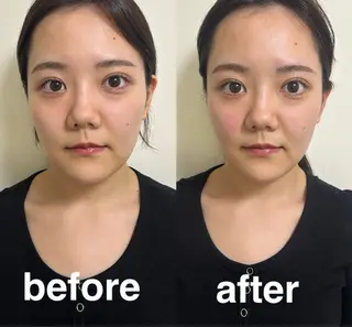 美容鍼灸サロン mahoroba院長のエステ・リラクイメージ