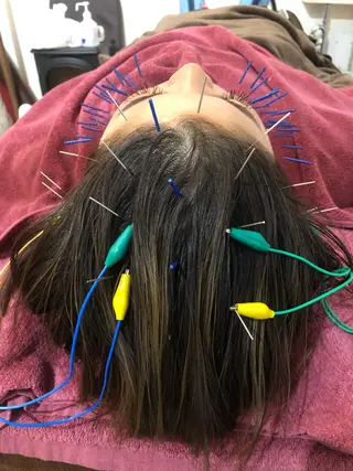 美容鍼灸女性専用 りんご鍼灸治療院のエステ・リラクイメージ