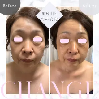 トータルビューティー サロンBL∞Mのエステ・リラクイメージ