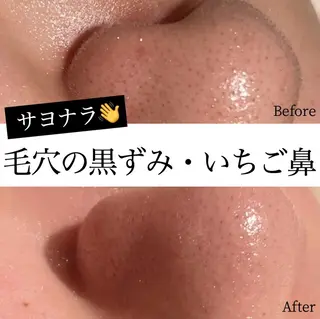 CHERIE所属・CHERIE Hisadaのエステ・リラクイメージ