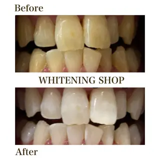 セルフホワイトニングショップ静岡葵区店所属・もえか静岡葵区店ホ ワイトニングショップのその他イメージ