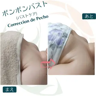 小顔矯正☀︎バスト ☀︎ハルのエステ・リラクイメージ