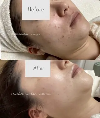 都度払い 肌質改善専門サロンのエステ・リラクイメージ