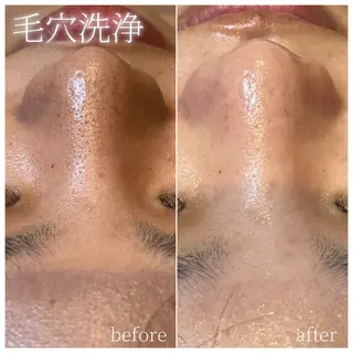 La Dusa 韓国肌管理/小波のエステ・リラクイメージ