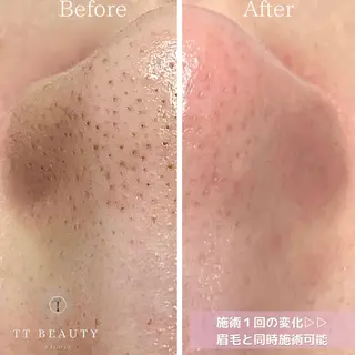 アイブロウ TT Beauty所属・TT Beautyの眉毛・アイブロウイメージ