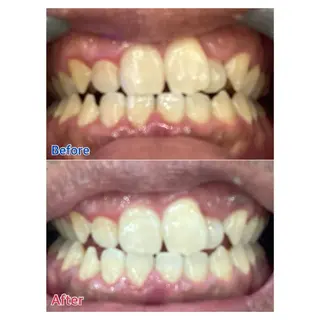 MBEAUTYSALON 千葉店・京成大久保所属・Melty 輝のその他イメージ