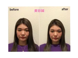 チキバン美容鍼灸整体 サロン心斎橋店のエステ・リラクイメージ