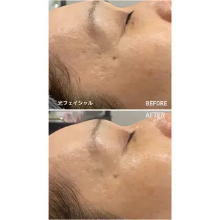 毛穴洗浄・痩身・脱毛 /アルカンジュのエステ・リラクイメージ