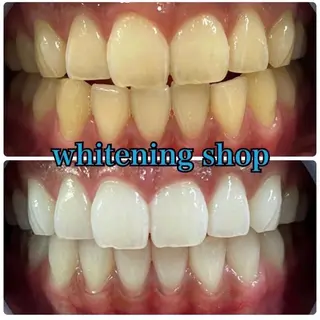 ホワイトニング ショップ吉祥寺店のエステ・リラクイメージ