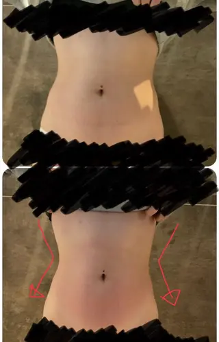 【痩身ダイエット・リンパオイルマッサージ・脱毛】- iromie. 四日市店 - 医療提携所属・佐々木 千愛来のエステ・リラクイメージ