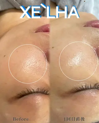 天神 MeMeのエステ・リラクイメージ