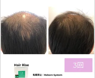 【福岡市西区 エステ】 GRANVIR(グランヴィール)所属・GRANVIR グランヴィールのエステ・リラクイメージ