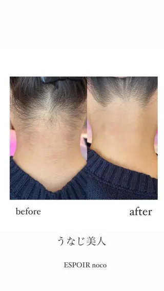 ワックス脱毛🌈 ESPOIRnocoのエステ・リラクイメージ