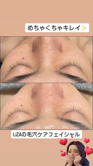 LiZA エステティックサロンのその他イメージ