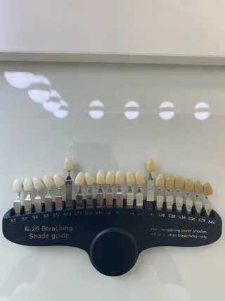 エクシアホワイトニング草津店所属・nanami -ホワイトニングのその他イメージ