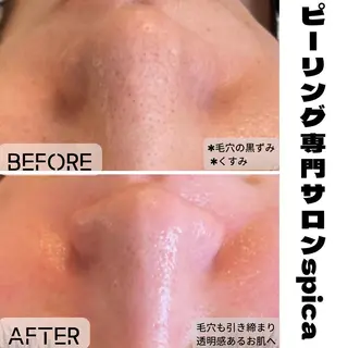 ピーリング専門サロン Spicaのエステ・リラクイメージ