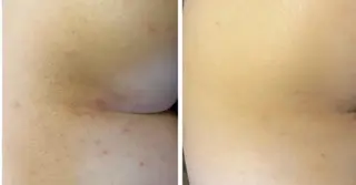 べアール所属・小顔/毛穴/ニキビ salon bealのエステ・リラクイメージ