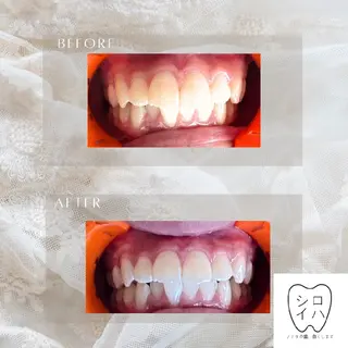 ホワイトニングサロン シロイハ所属・歯を白くしたい方🦷 シロイハのその他イメージ