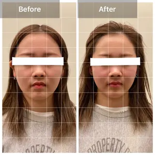 美容鍼/ヘッドスパ/ 💎さかもとのエステ・リラクイメージ