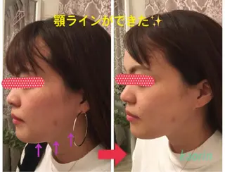 小顔矯正サロン顔凛 KANAのエステ・リラクイメージ