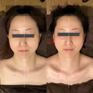 ニキビ･毛穴悩み特化 /CHISATOのエステ・リラクイメージ