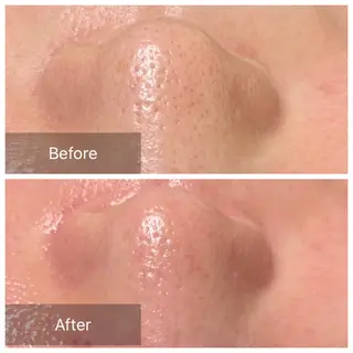 産毛専門店 Bittoのエステ・リラクイメージ