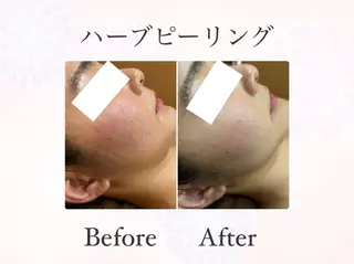 ハーブピーリング専門 muro.のエステ・リラクイメージ