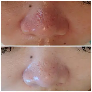 Lussera(ルセラ)所属・肌質を変えて すっぴん肌に✨のその他イメージ