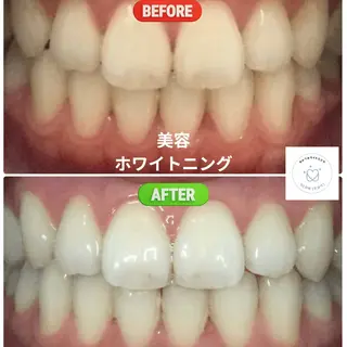 歯のセルフホワイトニング専門店GLOW（グロウ）所属・東区香椎歯のセルフホ ワイトニングGLOWのその他イメージ