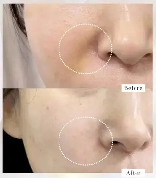 ショート aliaハイフ&水光ジェットサロン所属・aliaハーブ水光店 エステティシャン募集のエステ・リラクイメージ