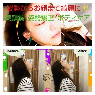 むくみたるみ専門☆ 美容鍼・小顔矯正のエステ・リラクイメージ