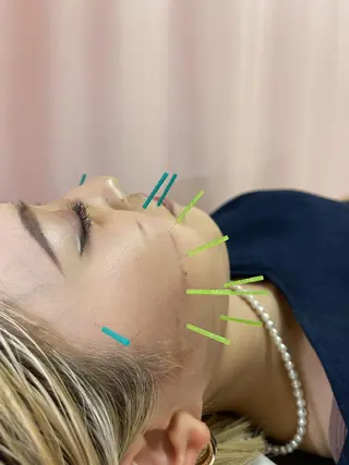 同心整骨院 美容鍼・整体・小顔のエステ・リラクイメージ