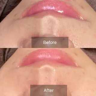 産毛専門店 Bittoのエステ・リラクイメージ