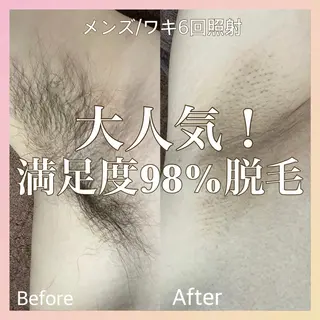 MINOA  大野城店所属・小林 千愛のエステ・リラクイメージ