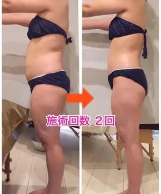 ロング カラー パーマ ヘアアレンジ メンズ キッズ ネイル マツエク・マツパ ‍痩身＆ボディ 結果出し🌟丹野のエステ・リラクイメージ