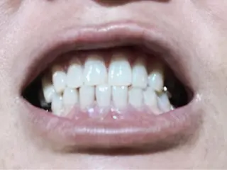 ホワイトニングジム 池袋のその他イメージ