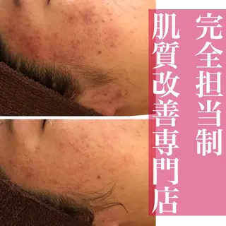 ミディアム カラー パーマ ヘアアレンジ メンズ キッズ ネイル マツエク・マツパ ニキビ・肌質改善専門 ♡人生が変わるサロンのエステ・リラクイメージ