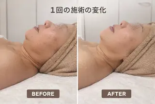 【歴13年】劇的小顔 D rマジックタッチのエステ・リラクイメージ