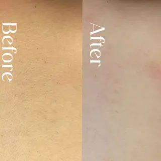 Hit. シュガーリング豊橋のエステ・リラクイメージ