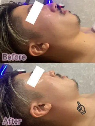 LAGRECE 大阪梅田店のエステ・リラクイメージ