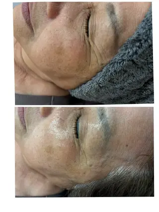 ニキビ毛穴専門店Beautysalon Luana所属・小林 まいのエステ・リラクイメージ