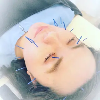 妙蓮寺ゆう鍼灸院所属・太田祐志 /中医美容鍼のエステ・リラクイメージ