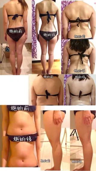 ショート カラー パーマ ヘアアレンジ メンズ キッズ ネイル マツエク・マツパ 強圧オールハンド痩身&黄土よもぎ蒸しプライベートサロンClematis池袋所属・強圧オールハンド痩身 片野のエステ・リラクイメージ