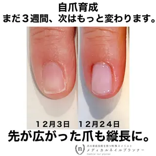 ネイル NAIL SALON ｔｏｇｇｙのネイルデザイン