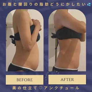 ﾌﾟﾗｲﾍﾞｰﾄｻﾛﾝ アンクチュール所属・UnCouture 〜アンクチュール〜のエステ・リラクイメージ